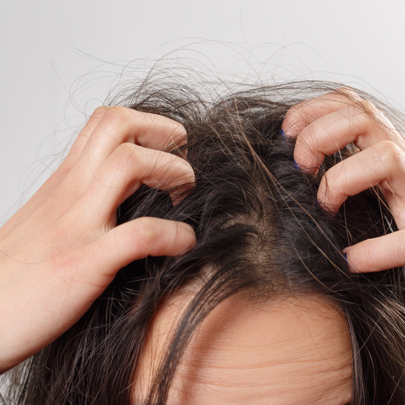 Top 5 des meilleurs shampoings anti-démangeaisons 6